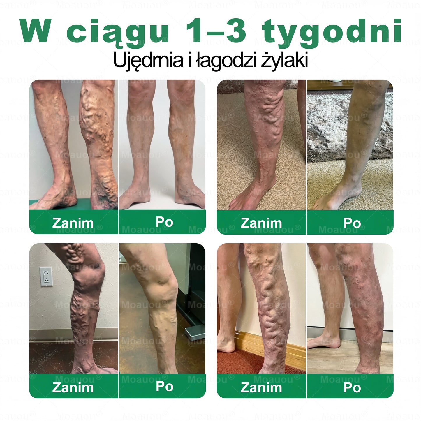🎁 Au mai rămas doar 5 cutii! Vă oferim o reducere suplimentară de 50%! Obțineți -vă în formă și sănătos. Pierdeți acum și nu veți mai avea altă șansă până anul viitor.