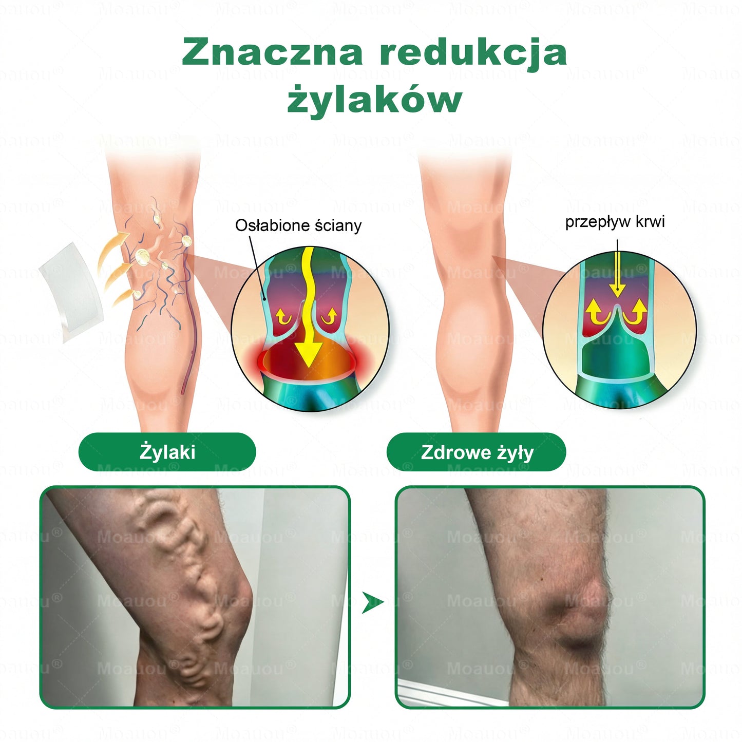 🎁 Au mai rămas doar 5 cutii! Vă oferim o reducere suplimentară de 50%! Obțineți -vă în formă și sănătos. Pierdeți acum și nu veți mai avea altă șansă până anul viitor.