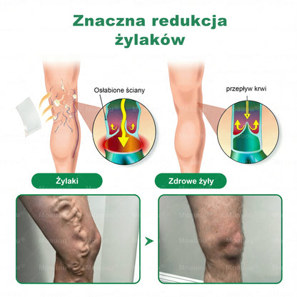 🎁 Au mai rămas doar 5 cutii! Vă oferim o reducere suplimentară de 50%! Obțineți -vă în formă și sănătos. Pierdeți acum și nu veți mai avea altă șansă până anul viitor.